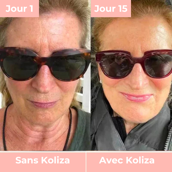 Masque LED Pour Visage | Koliza